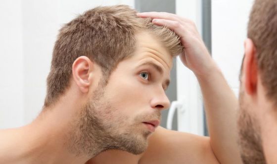Caduta capelli: cosa fare?