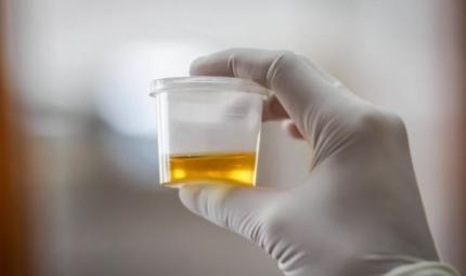 Analisi cliniche: l'urinocoltura