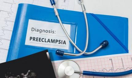 Preeclampsia: importante la diagnosi tempestiva