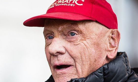 Niki Lauda e quelle cicatrici sul viso