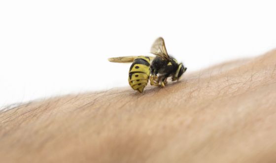 Come trattare una puntura d'ape in modo naturale