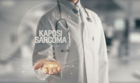 Tumori rari: il sarcoma di Kaposi