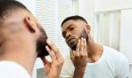 Salute dell'uomo: la follicolite della barba