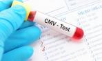 Infezioni da citomegalovirus: come si trasmettono