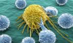 Nanofuturo d'oro nella cura dei tumori