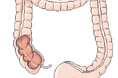 L'intestino crasso