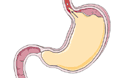 Patologie gastriche