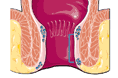 L'intestino retto