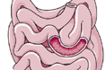 L'intestino tenue